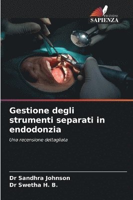 Sandhra Johnson, Swetha H B, Swetha H. B., Dr Sandhra Johnson, Dr Swetha H. B. - Gestione degli strumenti separati in endodonzia, Häftad