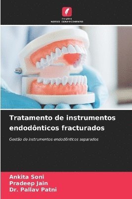 Ankita Soni, Pradeep Jain, Pallav Patni - Tratamento de instrumentos endodônticos fracturados, Häftad