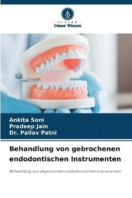 Ankita Soni, Pradeep Jain, Pallav Patni - Behandlung von gebrochenen endodontischen Instrumenten, Häftad