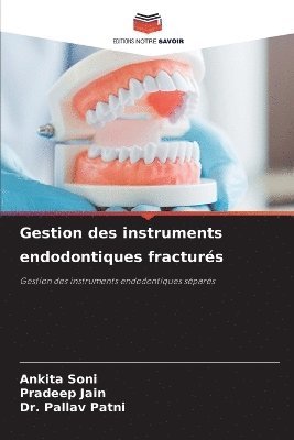 Ankita Soni, Pradeep Jain, Pallav Patni - Gestion des instruments endodontiques fracturés, Häftad