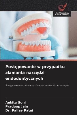 Ankita Soni, Pradeep Jain, Pallav Patni - Postępowanie w przypadku zlamania narzędzi endodontycznych, Häftad