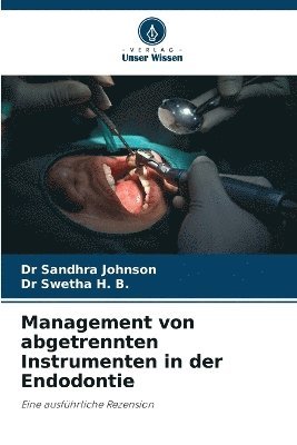 Sandhra Johnson, Swetha H B, Swetha H. B., Dr Sandhra Johnson, Dr Swetha H. B. - Management von abgetrennten Instrumenten in der Endodontie, Häftad