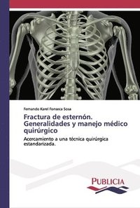 bokomslag Fractura de esternn. Generalidades y manejo mdico quirrgico