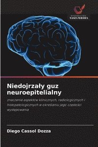 bokomslag Niedojrzaly guz neuroepitelialny