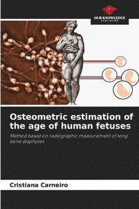 bokomslag Osteometric estimation of the age of human fetuses