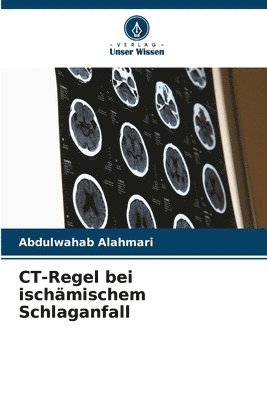 Abdulwahab Alahmari - CT-Regel bei ischämischem Schlaganfall, Häftad