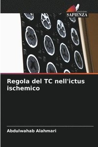 bokomslag Regola del TC nell'ictus ischemico