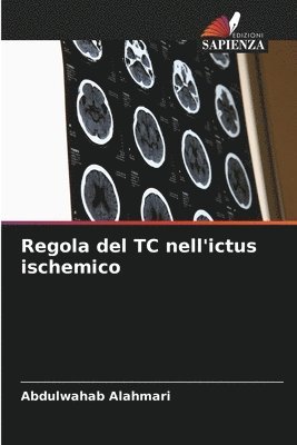 Abdulwahab Alahmari - Regola del TC nell'ictus ischemico, Häftad
