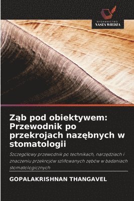 bokomslag Z?b pod obiektywem: Przewodnik po przekrojach naz?bnych w stomatologii
