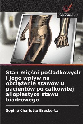 bokomslag Stan mi??ni po?ladkowych i jego wplyw na obci??enie stawów u pacjentów po calkowitej alloplastyce stawu biodrowego