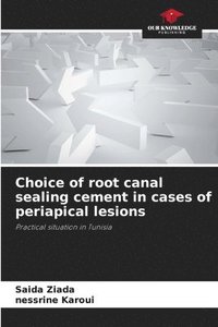bokomslag Choice of root canal sealing cement in cases of periapical lesions