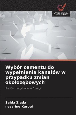 bokomslag Wybór cementu do wypelnienia kanalów w przypadku zmian okoloz?bowych