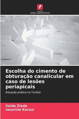 bokomslag Escolha do cimento de obturação canalicular em caso de lesões periapicais