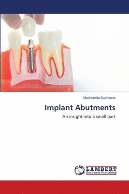 Implant Abutments 1