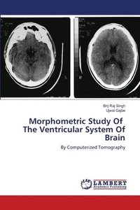 bokomslag Morphometric Study Of The Ventricular System Of Brain