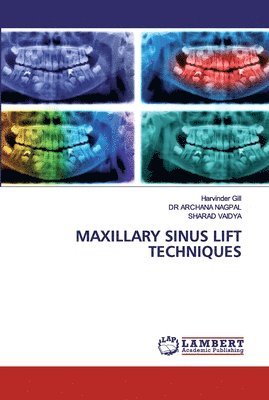 Harvinder Gill, Archana Nagpal, Sharad Vaidya - Maxillary Sinus Lift Techniques, Häftad