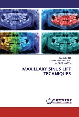 bokomslag Maxillary Sinus Lift Techniques