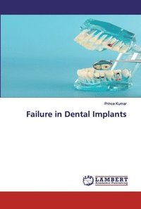 bokomslag Failure in Dental Implants