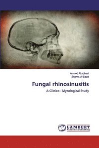 bokomslag Fungal rhinosinusitis