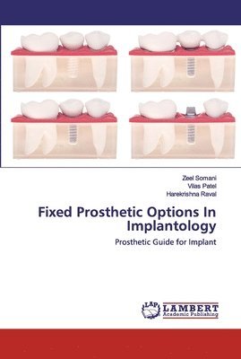 Fixed Prosthetic Options In Implantology 1