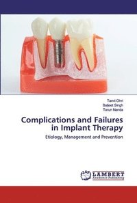 bokomslag Complications and Failures in Implant Therapy