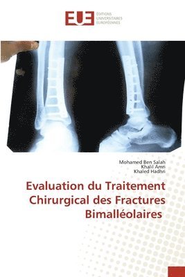 Evaluation du Traitement Chirurgical des Fractures Bimalleolaires 1