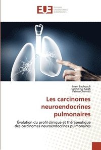 bokomslag Les carcinomes neuroendocrines pulmonaires
