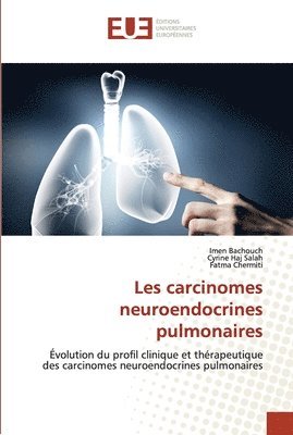 bokomslag Les carcinomes neuroendocrines pulmonaires