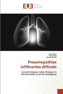 Pneumopathies infiltrantes diffuss 1