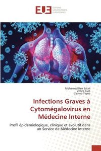 bokomslag Infections Graves  Cytomgalovirus en Mdecine Interne