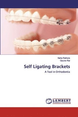 bokomslag Self Ligating Brackets