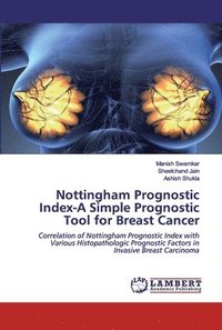 bokomslag Nottingham Prognostic Index-A Simple Prognostic Tool for Breast Cancer