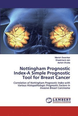 Nottingham Prognostic Index-A Simple Prognostic Tool for Breast Cancer 1