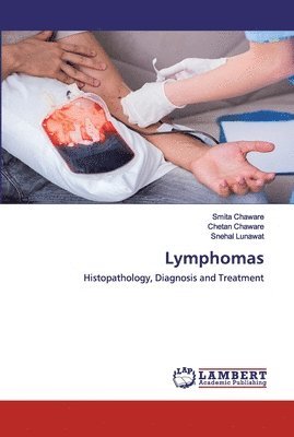 bokomslag Lymphomas