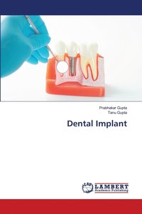 bokomslag Dental Implant