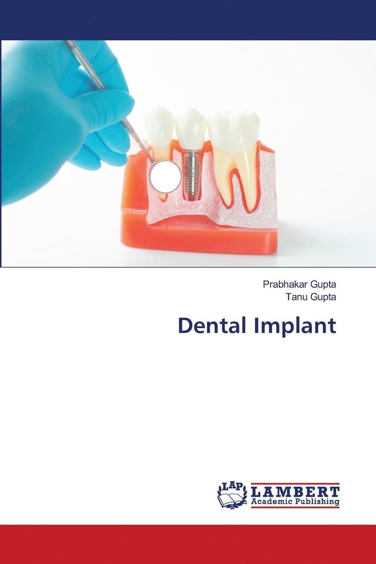Dental Implant 1