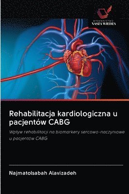 Rehabilitacja kardiologiczna u pacjentów CABG