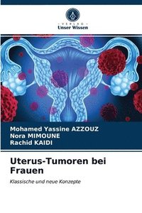 bokomslag Uterus-Tumoren bei Frauen