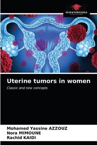 bokomslag Uterine tumors in women