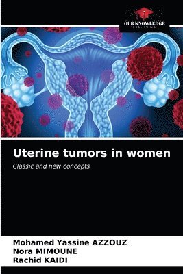 Uterine tumors in women 1