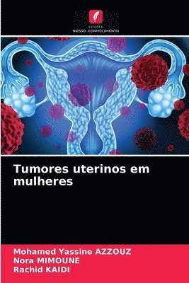 Tumores uterinos em mulheres 1