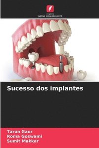 bokomslag Sucesso dos implantes