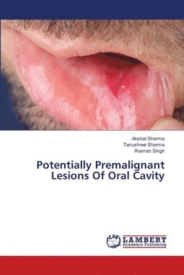 Potentially Premalignant Lesions Of Oral Cavity 1