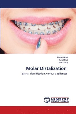 bokomslag Molar Distalization