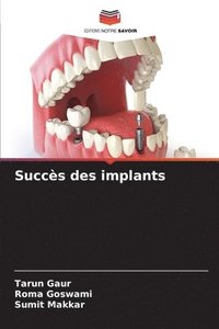 bokomslag Succès des implants