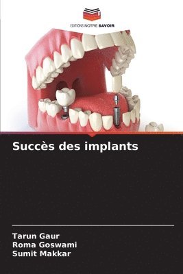 bokomslag Succs des implants