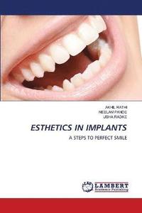 bokomslag Esthetics in Implants