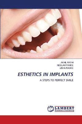 Esthetics in Implants 1