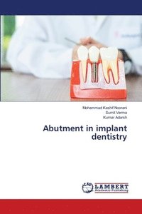 bokomslag Abutment in implant dentistry