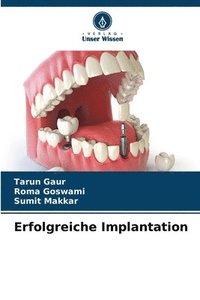 bokomslag Erfolgreiche Implantation